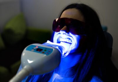 Laser Tooth Whitening Treatment in Delhi, India