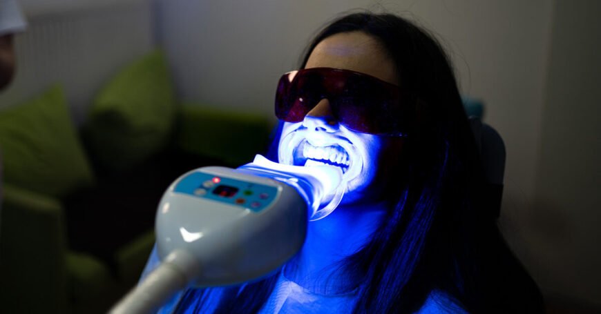 Laser Tooth Whitening Treatment in Delhi, India