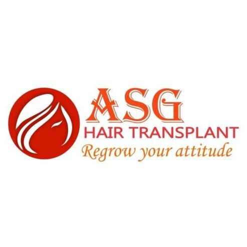 ASG Hair Transplant Centre | Hair Transplant in Ludhiana