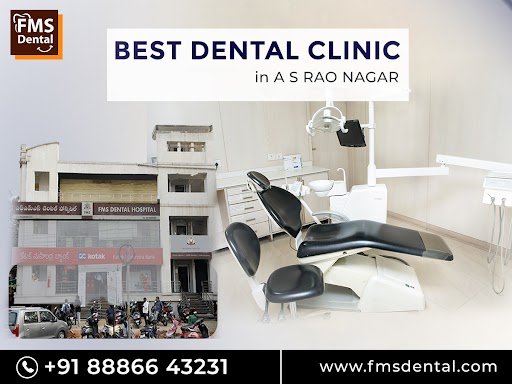 Best Dental Implant Clinic in AS Rao Nagar – FMS Dental Clinics